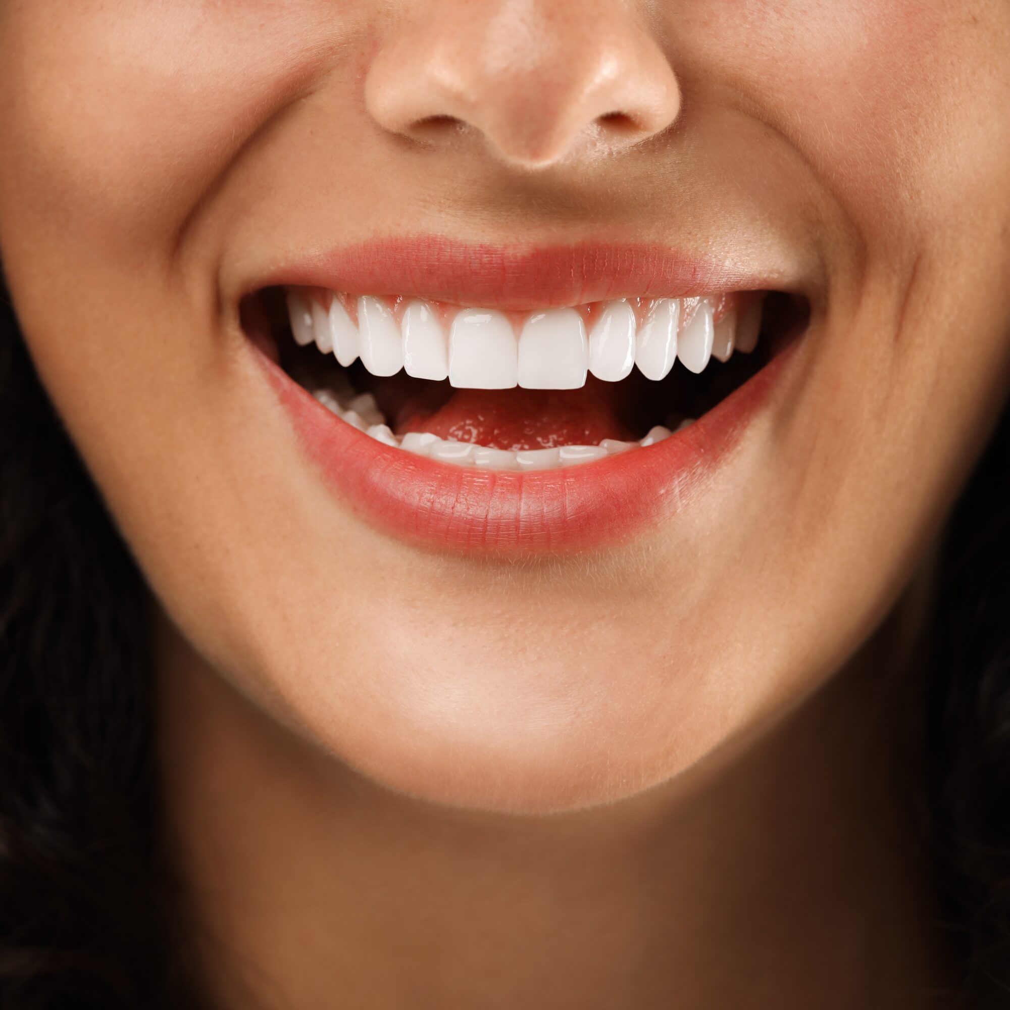 close-up of a young woman showing her flawless smile