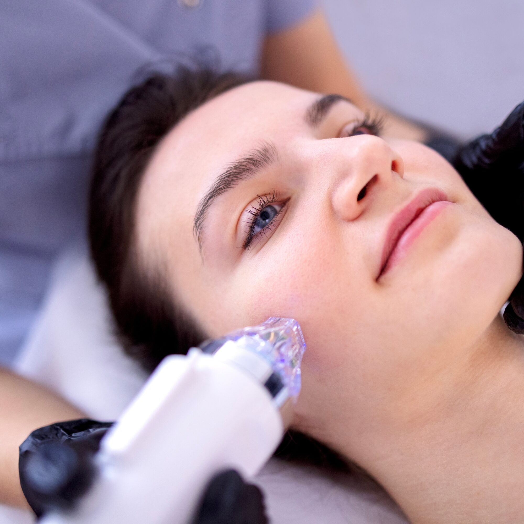 Microneedle RF lifting procedure. Hardware cosmetology. Beautician conducts a facial rejuvenation procedure for a brunette woman